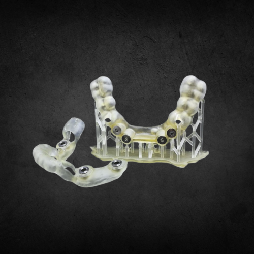 Fotópolimer nyomtatás (MSLA)