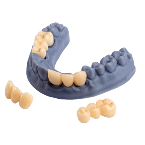 Crown & Bridge Pro DTech