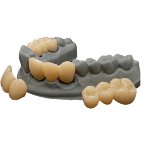 DTech Crown & Bridge Pro