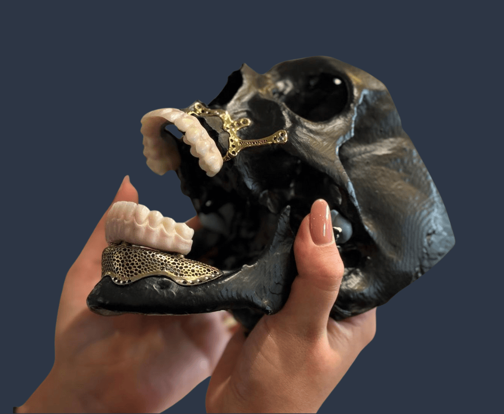 Subperiostalis impla